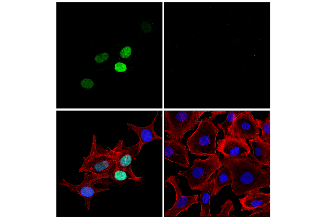 Immunofluorescence Image 1: Olig2 (E6G6Q) Rabbit Monoclonal Antibody (BSA and Azide Free)