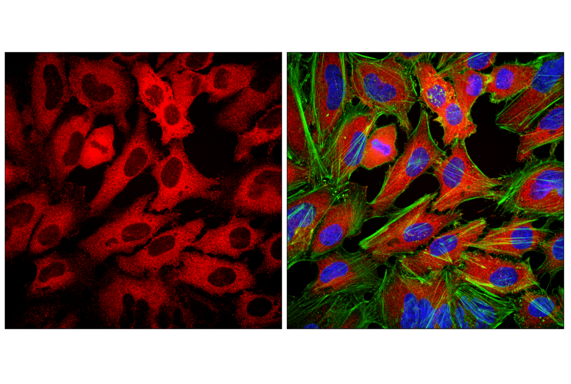 Immunofluorescence Image 1: Goat Anti-Mouse IgG2b Antibody (Alexa Fluor<sup>®</sup> 647 Conjugate)