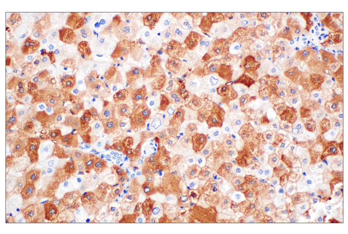 Immunohistochemistry Image 5: FTL (F9O4I) Rabbit Monoclonal Antibody