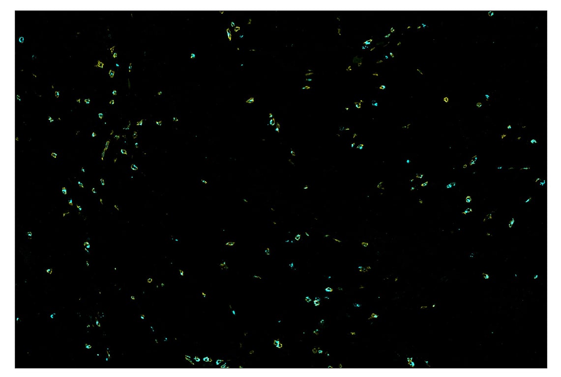Immunohistochemistry Image 7: CD8 alpha (D8A8Y) & CO-0004-594 SignalStar<sup>™</sup> Oligo-Antibody Pair