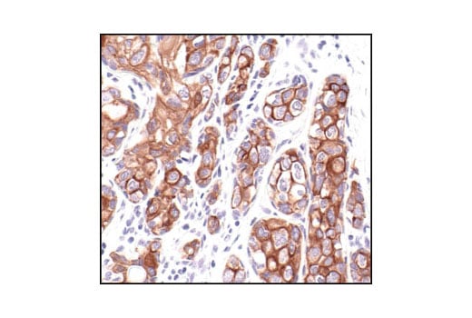 Immunohistochemistry Image 1: Keratin 8/18 (C51) Mouse Monoclonal Antibody