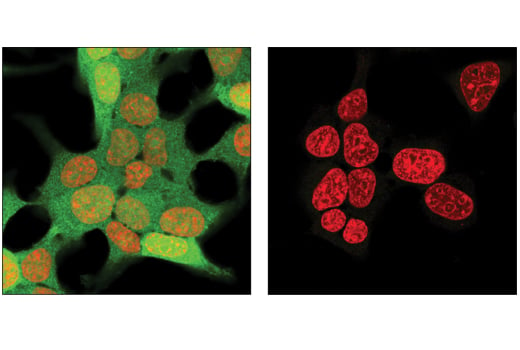 Immunofluorescence Image 2: 4E-BP1 (53H11) Rabbit mAb