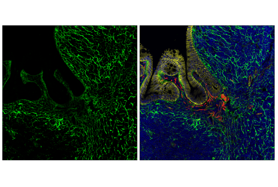 Immunofluorescence Image 2: COL1A1 (E8F4L) Rabbit Monoclonal Antibody