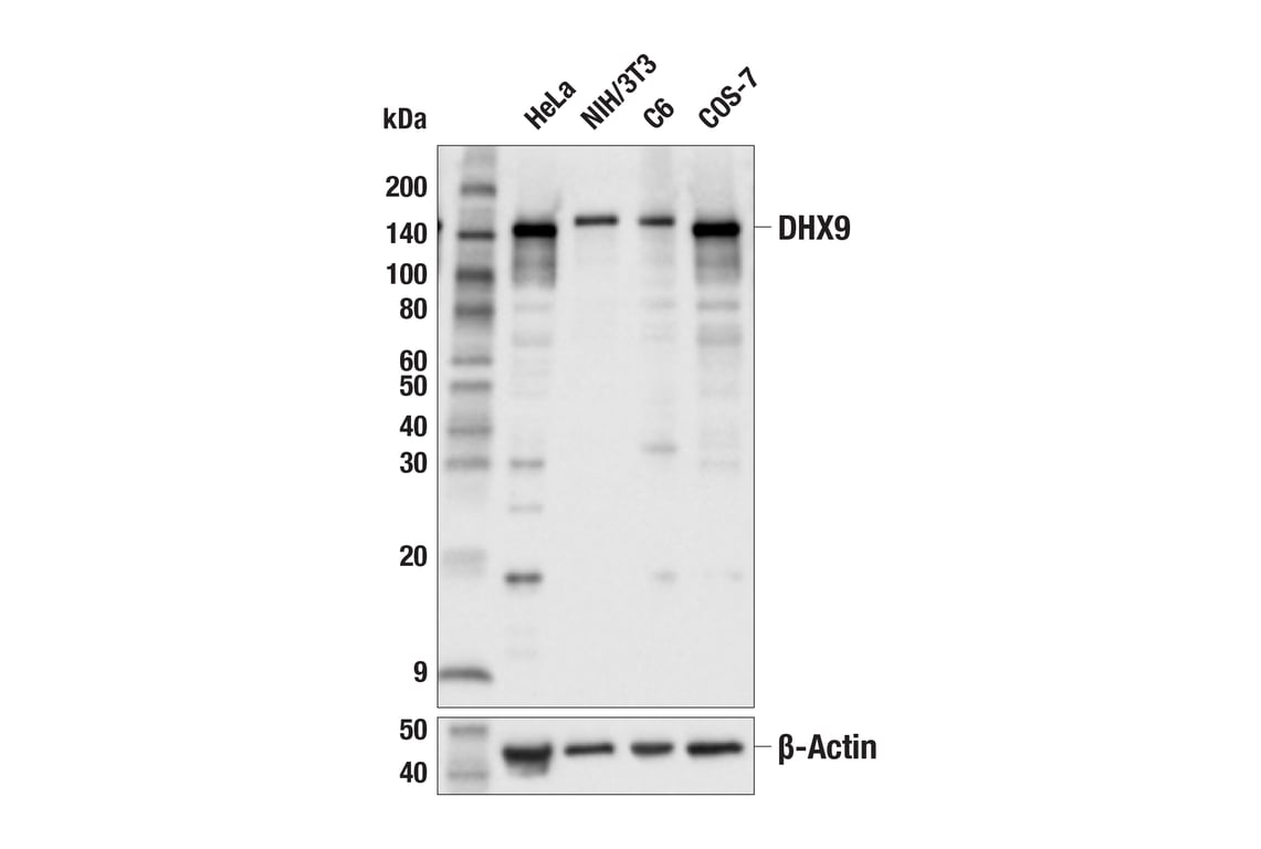 Western Blotting Image 1: DHX9 (E6M4Q) Rabbit mAb