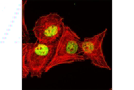 Immunofluorescence Image 1: STAG2 (D25A4) Rabbit Monoclonal Antibody