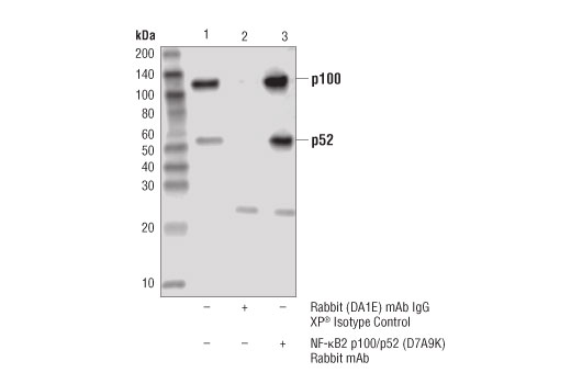undefined Image 21: NF-kappaB Family Antibody Sampler Kit II