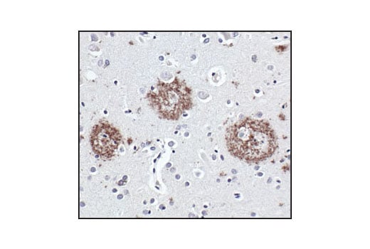 undefined Image 12: Alzheimer's Disease Antibody Sampler Kit