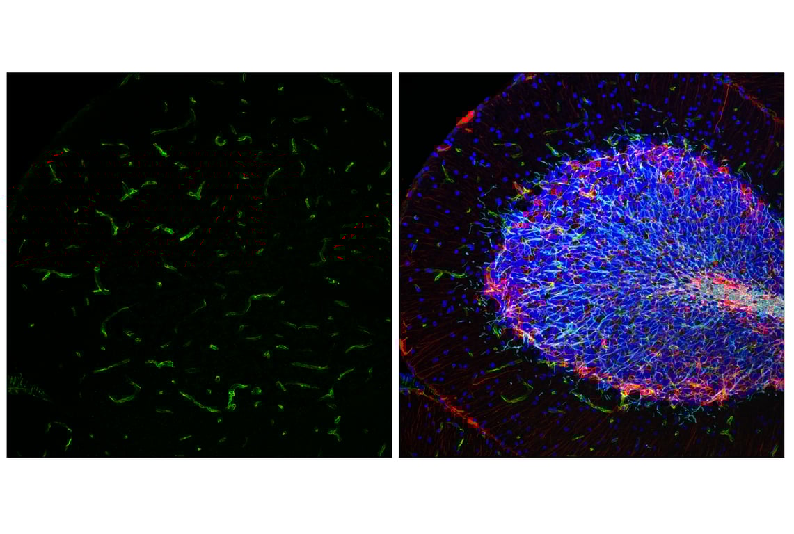 Immunofluorescence Image 2: Nestin (E5C7I) Rabbit Monoclonal Antibody (BSA and Azide Free)