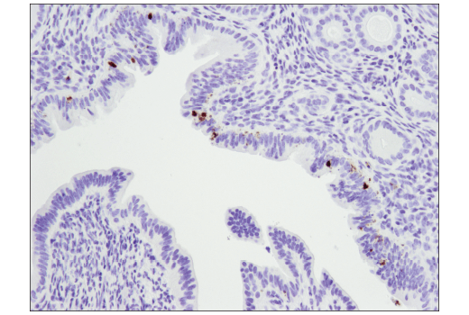 Immunohistochemistry Image 4: Cleaved PARP (Asp214) (D6X6X) Rabbit Monoclonal Antibody (BSA and Azide Free)