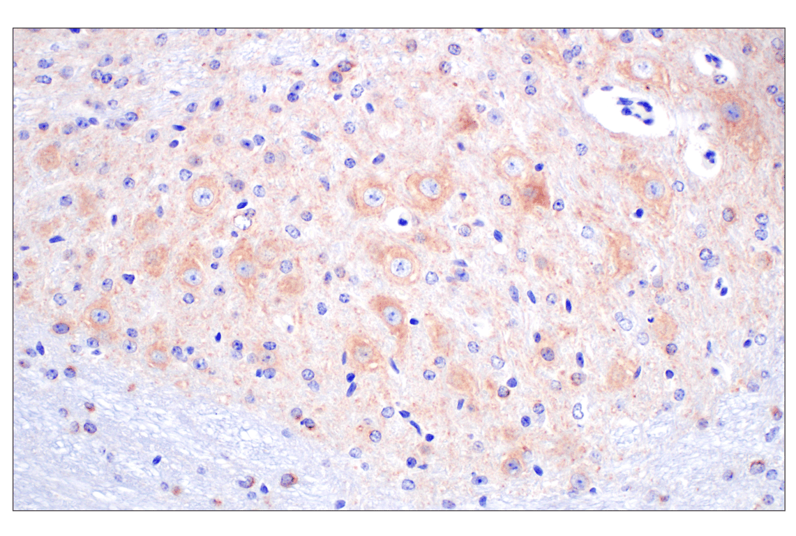 BACE1 (F4Z7X) Rabbit mAb | Cell Signaling Technology