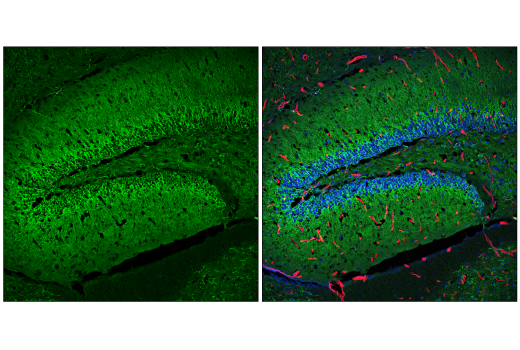 Immunofluorescence Image 1: CaMKII-gamma (E4C3O) Rabbit Monoclonal Antibody