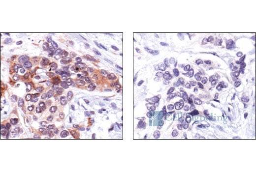Immunohistochemistry Image 8: Phospho-S6 Ribosomal Protein (Ser235/236) Antibody