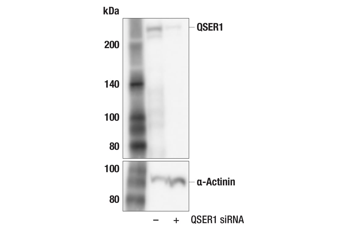 Western Blotting Image 2: QSER1 (F6Z3K) Rabbit Monoclonal Antibody