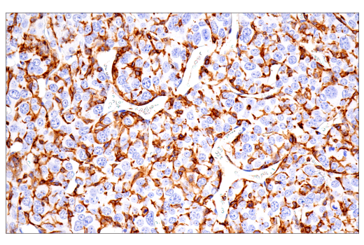 Immunohistochemistry Image 10: FcR gamma (E6Y1A) Rabbit Monoclonal Antibody