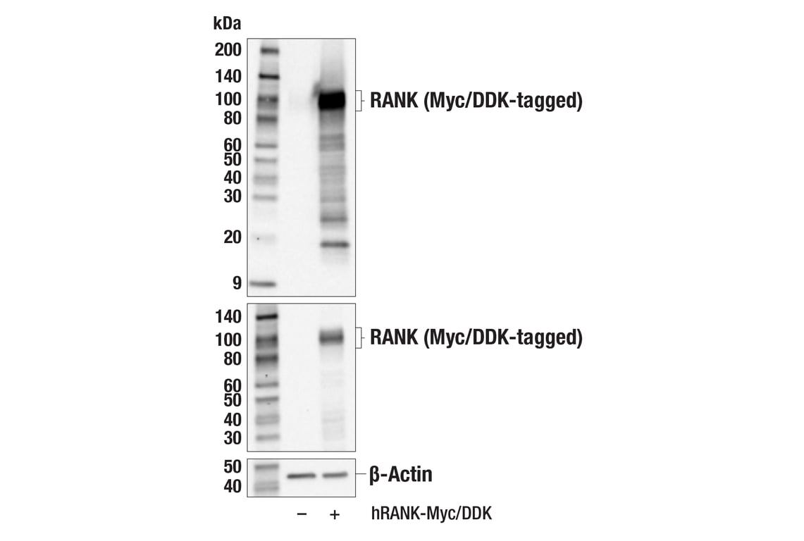 Western Blotting Image 2: RANK (E2N2Y) Rabbit Monoclonal Antibody