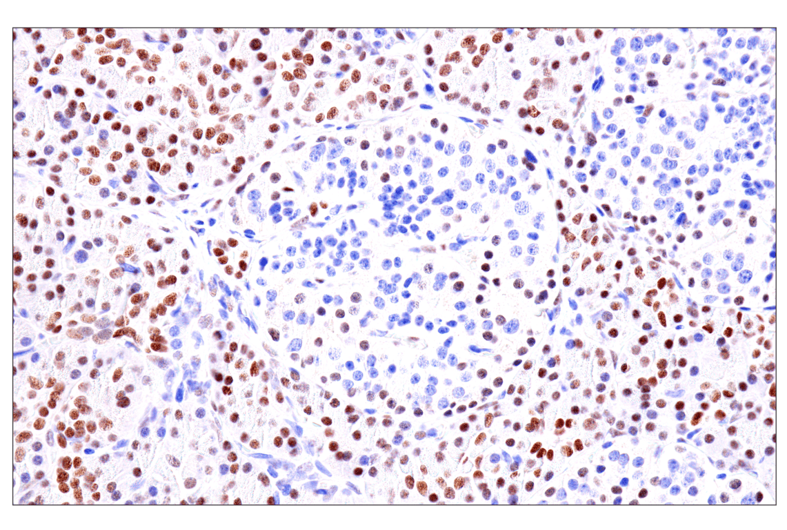 Immunohistochemistry Image 10: GATA-6 (D61E4) XP<sup>®</sup> Rabbit mAb (BSA and Azide Free)