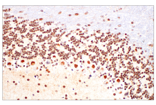 undefined Image 16: PhosphoPlus<sup>®</sup> Ezh2 (Thr311) Antibody Duet