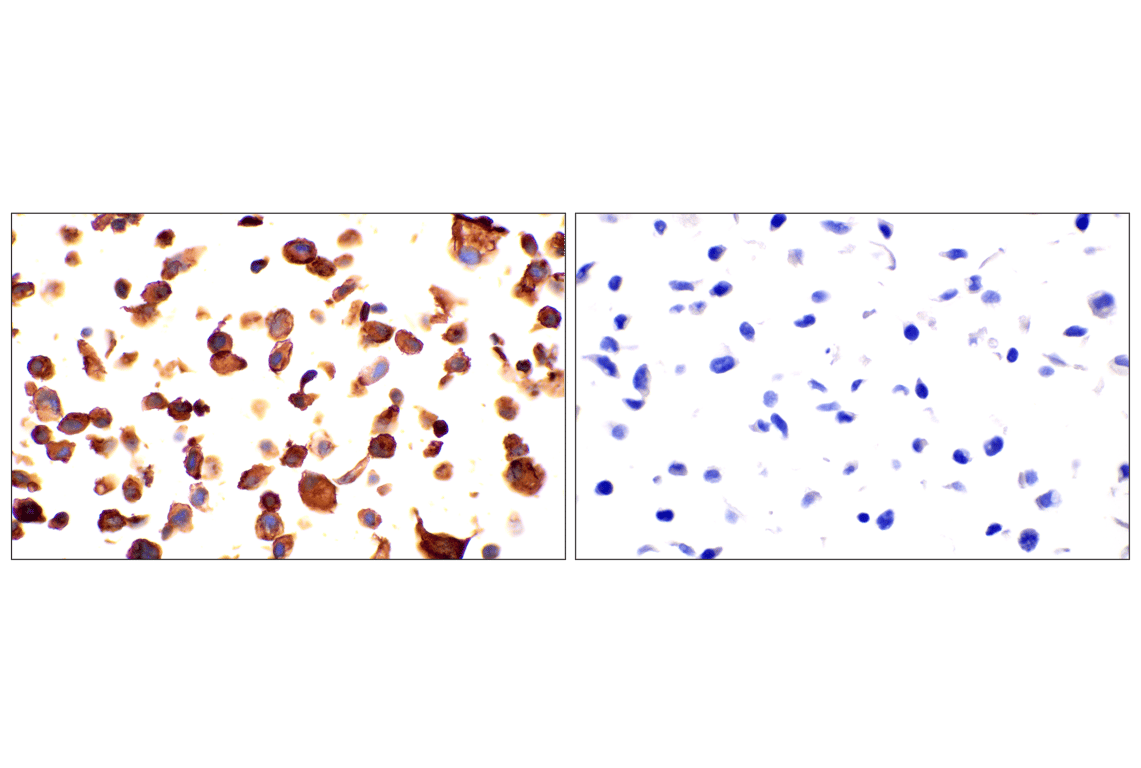 Immunohistochemistry Image 11: Neuropilin-2 (E5Q2G) Rabbit Monoclonal Antibody
