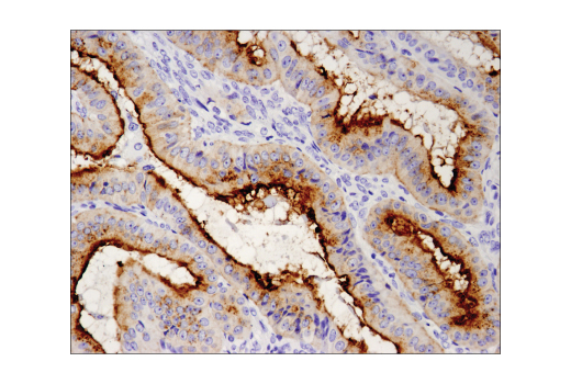 Immunohistochemistry Image 5: MUC1-C (D5K9I) Rabbit Monoclonal Antibody