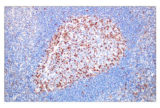 Immunohistochemistry Image 2: TIGIT (E5Y1W) Rabbit Monoclonal Antibody (BSA and Azide Free)
