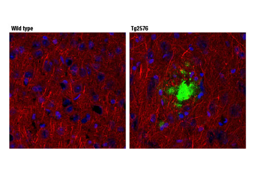 Immunofluorescence Image 1: beta-Amyloid (1-42) (D9A3A) Rabbit Monoclonal Antibody