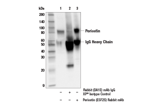 Immunoprecipitation Image 1: Periostin (E5F2S) Rabbit Monoclonal Antibody