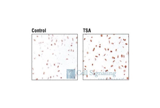 Immunohistochemistry Image 2: Acetyl-Histone H3 (Lys18) Antibody