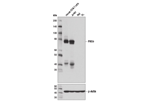 Western Blotting Image 2: PKC theta (E1I7Y) Rabbit Monoclonal Antibody