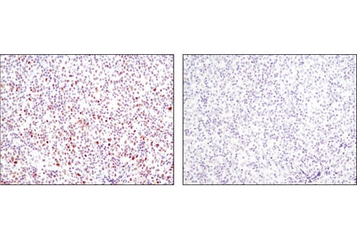 Phospho-Stat1 (Ser727) (D3B7) Rabbit mAb | Cell Signaling Phospho-Stat1 (Ser727) (D3B7) Rabbit mAb | Cell Signaling