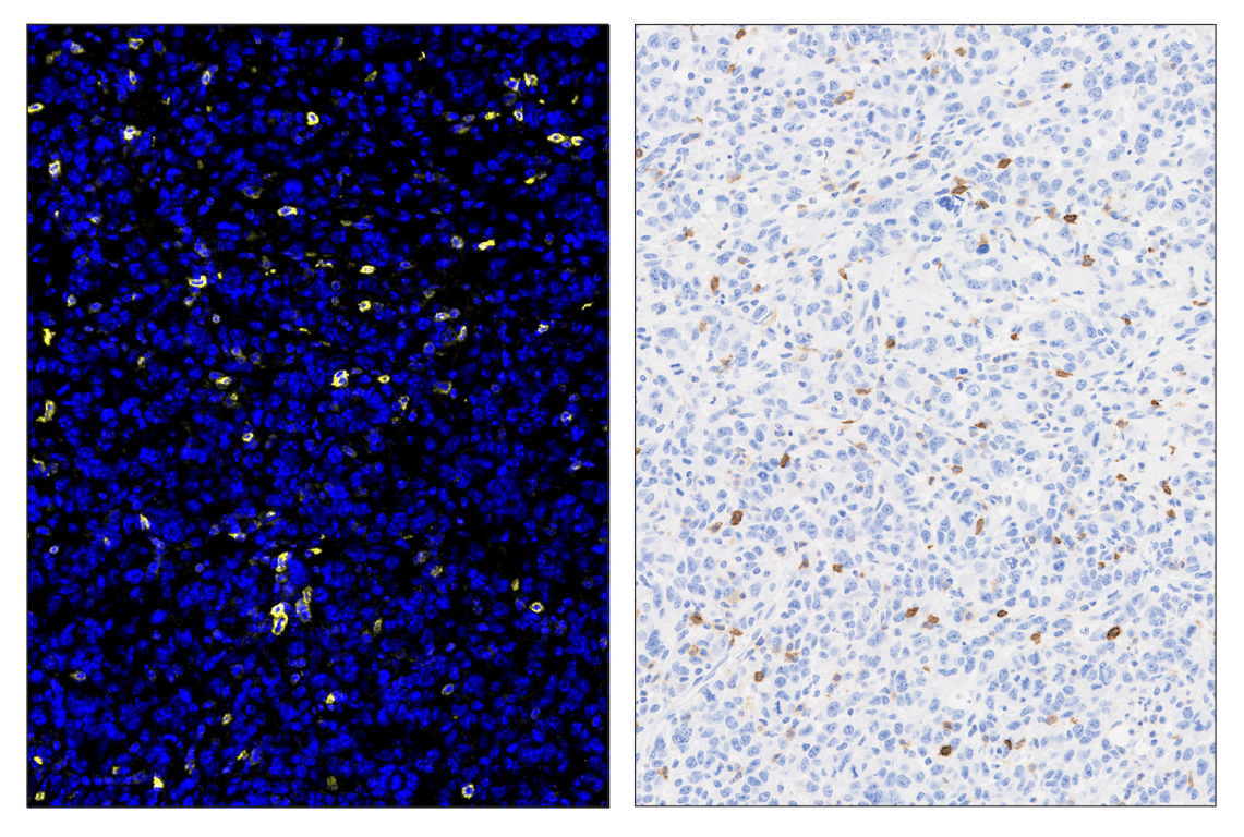 Immunohistochemistry Image 3: GITR (E9O9H) & CO-0186-488 SignalStar<sup>™</sup> Oligo-Antibody Pair