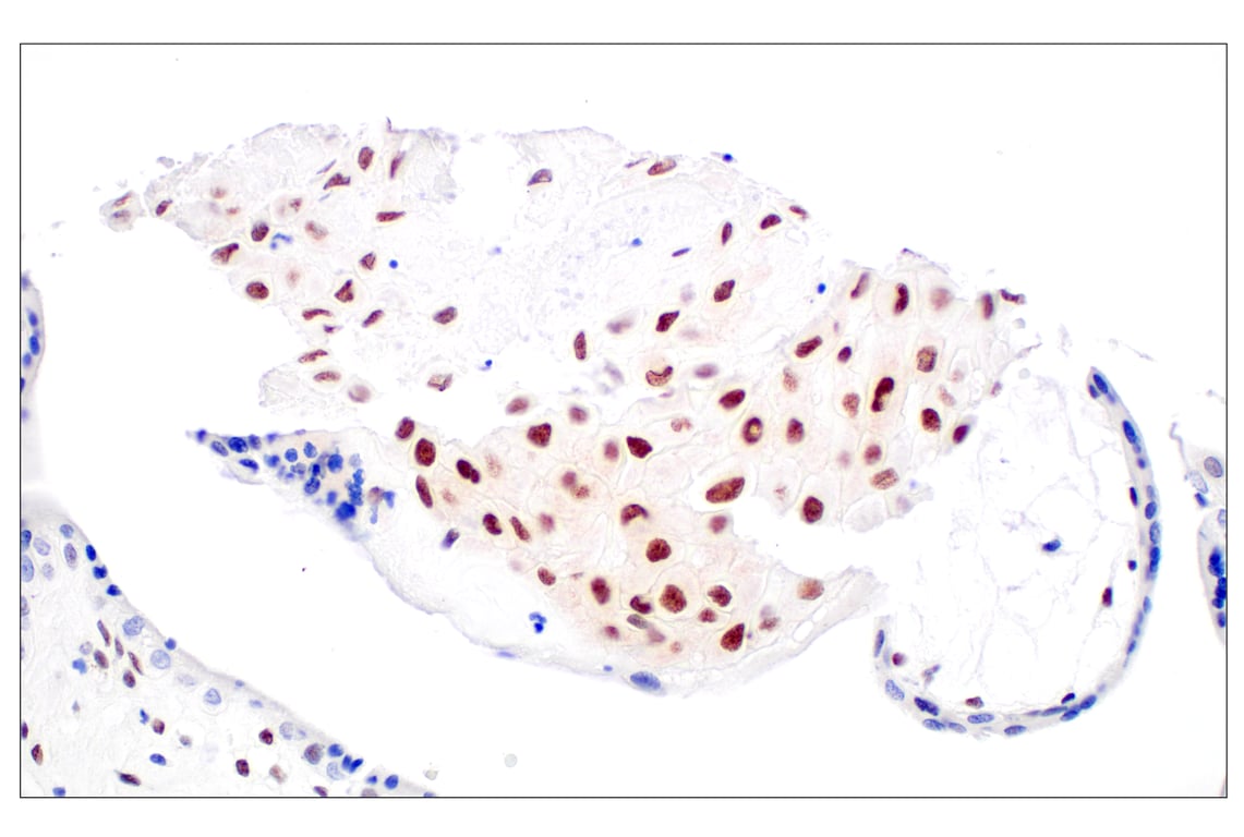 Immunohistochemistry Image 6: TCF12/HEB (E5R8X) Rabbit Monoclonal Antibody