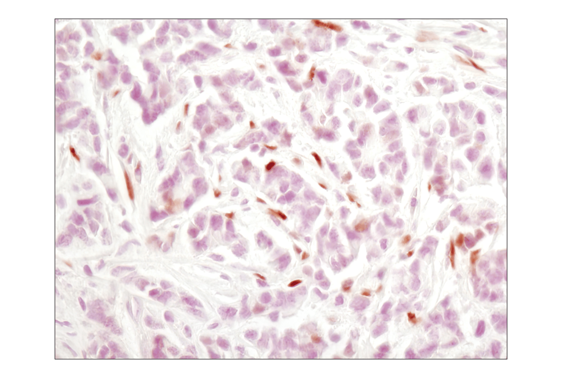 Immunohistochemistry Image 1: Phospho-Stat3 (Tyr705) (M9C6) Mouse Monoclonal Antibody