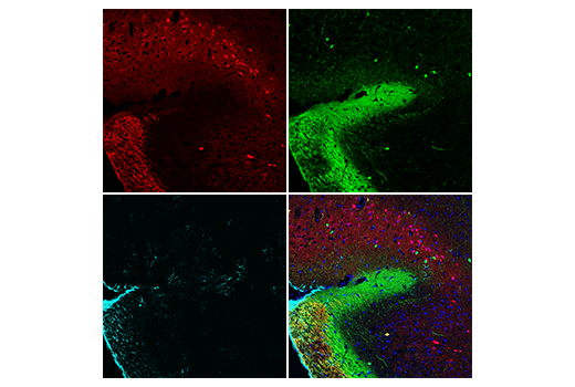 Immunofluorescence Image 4: Calretinin (E7R6O) XP<sup>®</sup> Rabbit mAb (BSA and Azide Free)