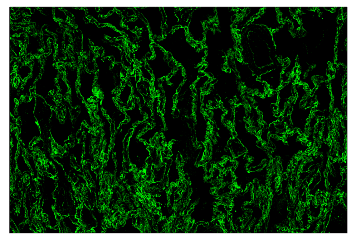 Immunohistochemistry Image 2: CD54/ICAM-1 (E3Q9N) & CO-0146-594 SignalStar<sup>™</sup> Oligo-Antibody Pair