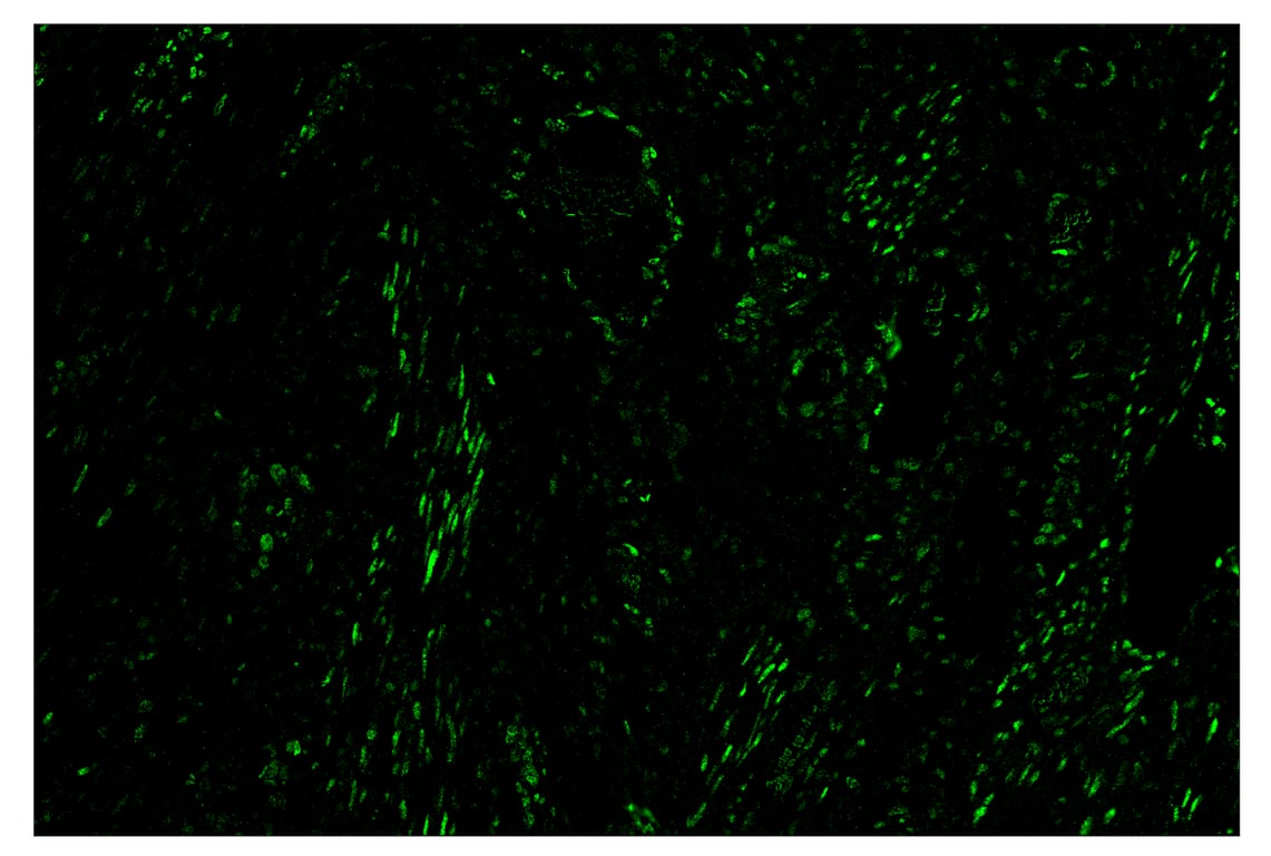 Immunohistochemistry Image 2: Phospho-Stat3 (Tyr705) (D3A7) & CO-0029-488 SignalStar<sup>™</sup> Oligo-Antibody Pair
