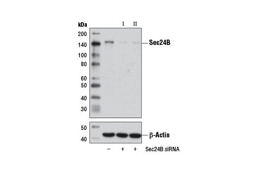 Western Blotting Image 1: Sec24B (D7D6S) Rabbit mAb