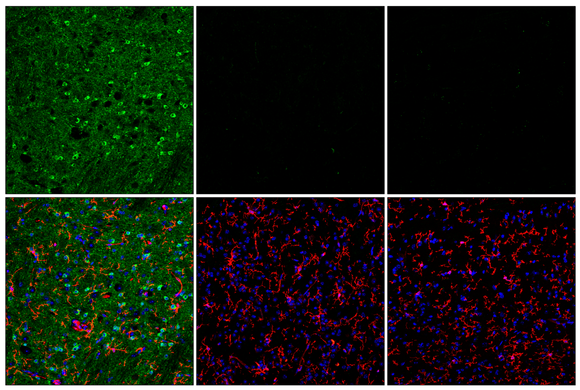 Immunofluorescence Image 1: Phospho-Tau (Ser404) (D2Z4G) Rabbit Monoclonal Antibody (BSA and Azide Free)