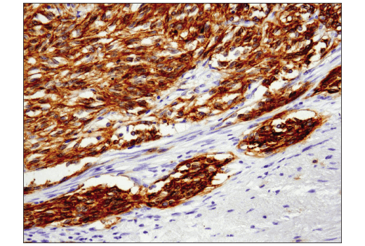Immunohistochemistry Image 2: c-Kit (D3W6Y) Rabbit Monoclonal Antibody (BSA and Azide Free)