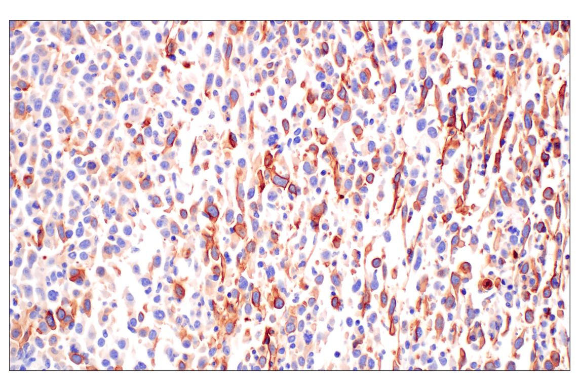 Immunohistochemistry Image 2: CD10/Neprilysin (F4P6H) Rabbit Monoclonal Antibody (BSA and Azide Free)