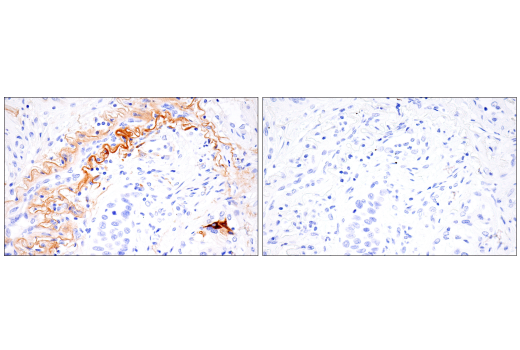 Immunohistochemistry Image 8: MMP-1 (E9S9N) Rabbit Monoclonal Antibody