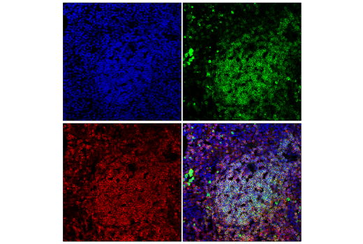 Immunofluorescence Image 2: SHP-1 (E1U6R) Rabbit Monoclonal Antibody