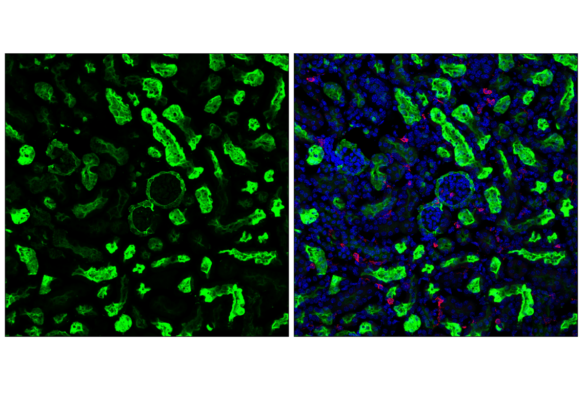 Immunofluorescence Image 1: CD10/Neprilysin (F4P6H) Rabbit Monoclonal Antibody