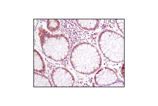 undefined Image 15: Translation Initiation Complex Antibody Sampler Kit