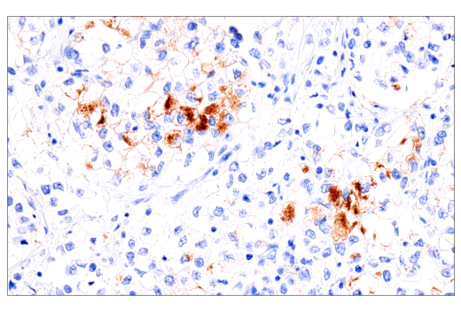 Immunohistochemistry Image 2: Fibrinogen gamma chain (E1U3Z) Rabbit Monoclonal Antibody (BSA and Azide Free)