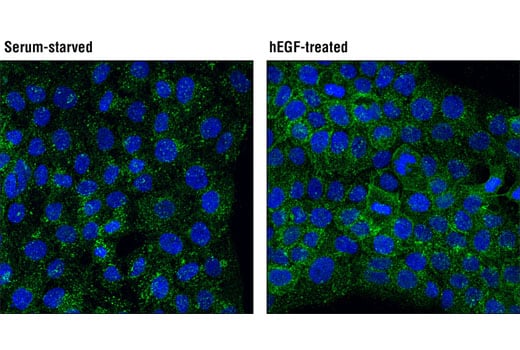 Immunofluorescence Image 1: Eps15 (D3K8R) Rabbit Monoclonal Antibody