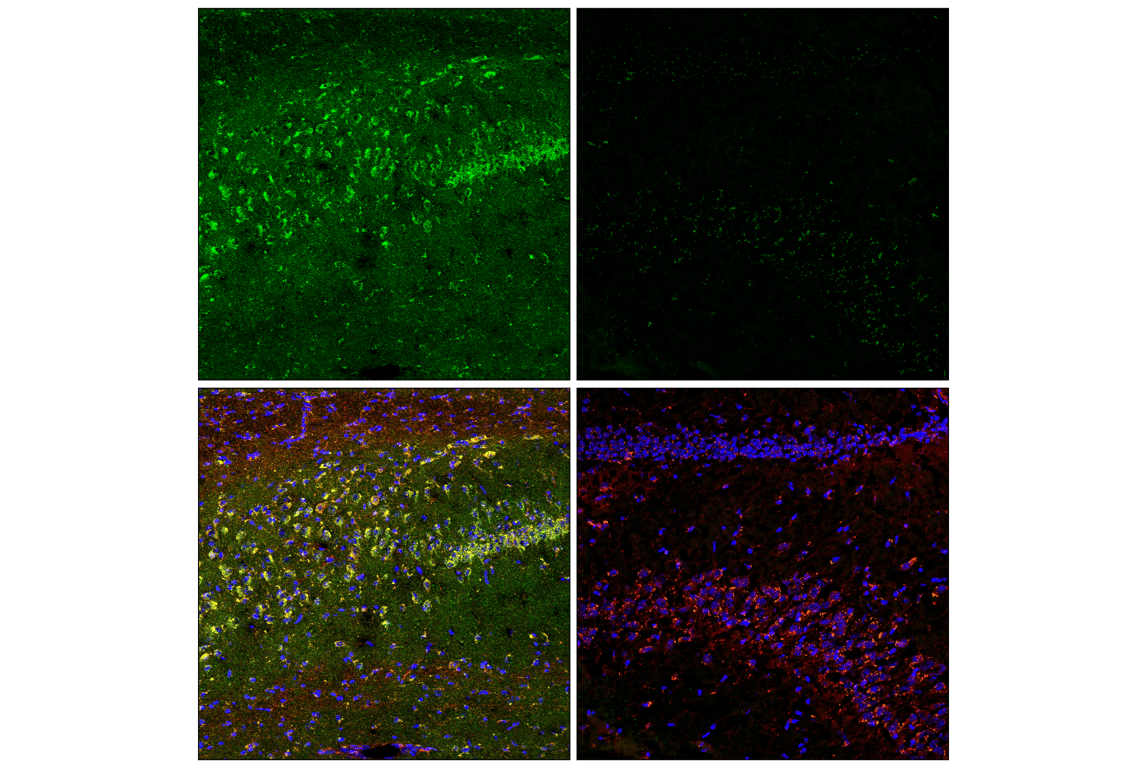Immunofluorescence Image 1: TMEM106B (E7H7Z) Rabbit Monoclonal Antibody
