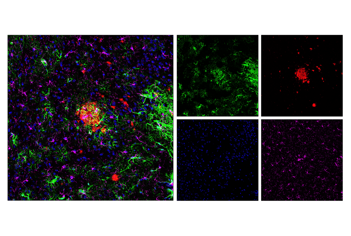 undefined Image 26: beta-Amyloid Mouse Model Neuronal Viability IF Antibody Sampler Kit