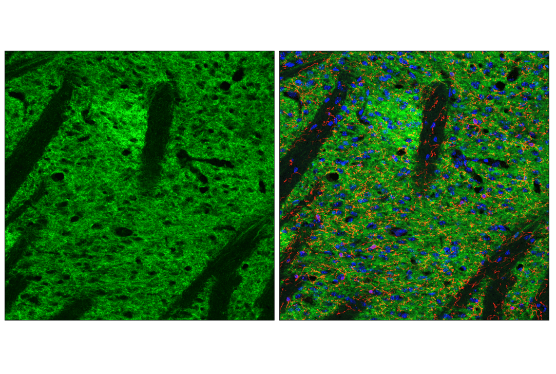 Immunofluorescence Image 1: GPR52 (E9D8W) Rabbit Monoclonal Antibody (BSA and Azide Free)