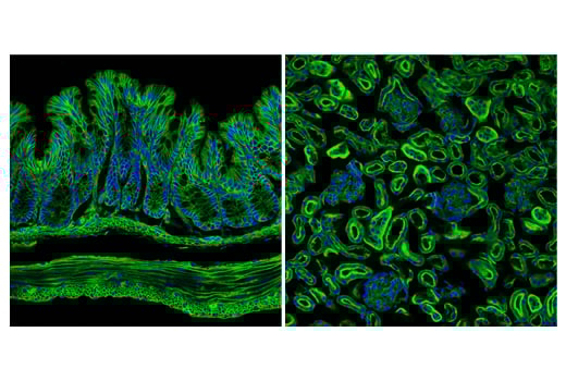 Immunofluorescence Image 2: Ras (E4K9L) Rabbit Monoclonal Antibody (BSA and Azide Free)