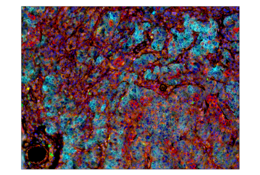 Immunohistochemistry Image 3: PD-1 (Intracellular Domain) (D4W2J) XP<sup>®</sup> Rabbit mAb (BSA and Azide Free)